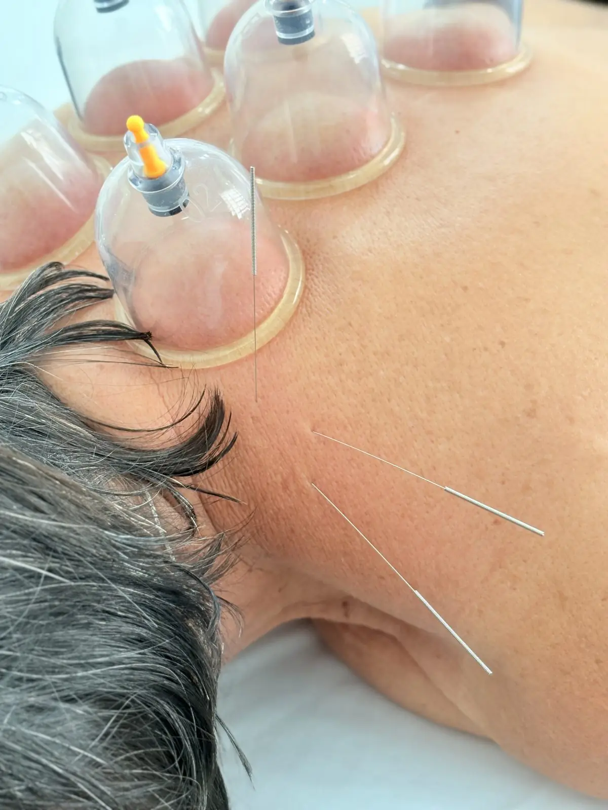 Atendimento de terapia na clínica